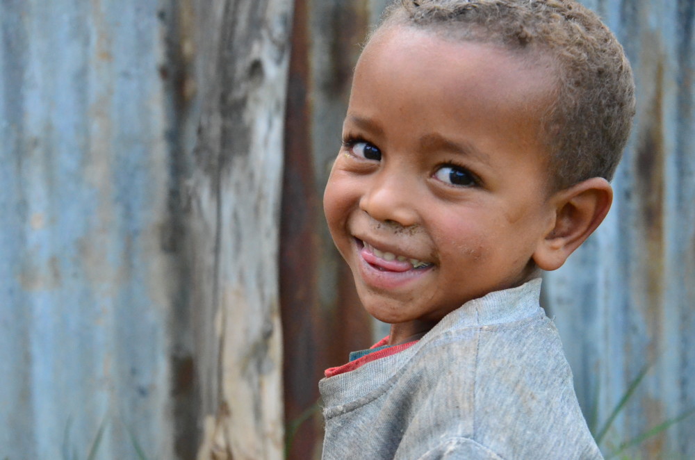 Ethiopian boy malnutrition smiling